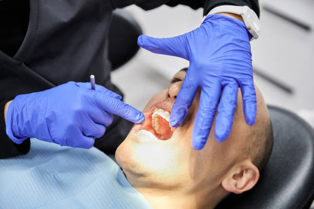 Best Dentist for Tooth Abscess  in Big Lake, TX